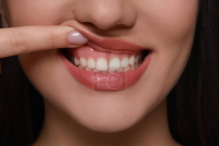Junge Frau zeigt gesundes Zahnfleisch, Nahaufnahme