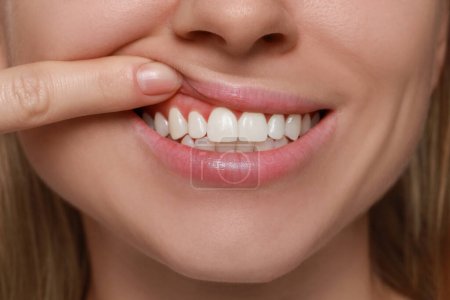 Photo for Young woman showing healthy gums, closeup view - Royalty Free Image