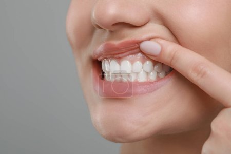 Frau mit gesundem Zahnfleisch auf grauem Hintergrund, Nahaufnahme. Raum für Text
