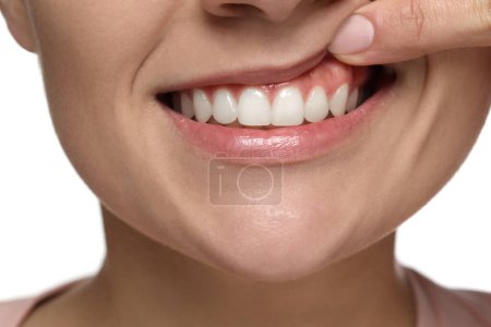 Frau zeigt gesundes Zahnfleisch auf weißem Hintergrund, Nahaufnahme