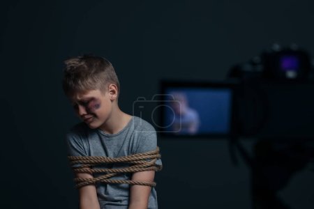 Foto de Little boy with bruises tied up and taken hostage near camera on dark background, selective focus - Imagen libre de derechos