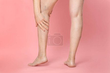 Photo for Closeup view of woman suffering from varicose veins on pink background - Royalty Free Image