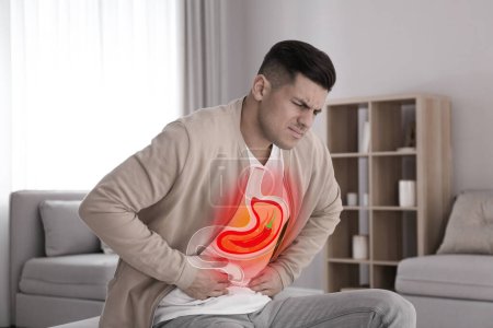 Mann leidet zu Hause an Sodbrennen. Magen mit scharfer Chilischote symbolisiert saure Verdauungsstörungen, Illustration