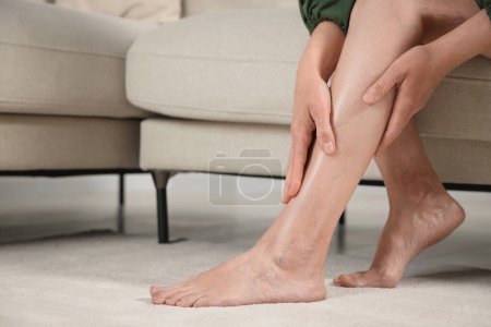 Téléchargez les photos : Barefoot woman with varicose veins on sofa in room, closeup - en image libre de droit