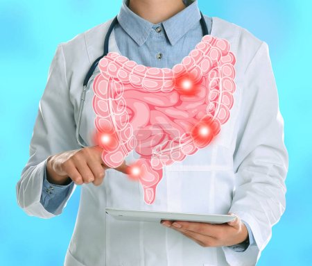 Téléchargez les photos : Gastroentérologue tenant un ordinateur tablette sur fond bleu clair, gros plan. Illustration des intestins avec des taches sur l'appareil - en image libre de droit