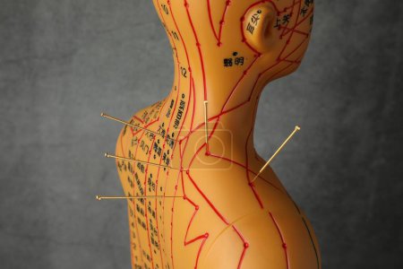 Téléchargez les photos : Acupuncture - médecine alternative. Modèle humain avec aiguilles à l'épaule sur fond gris foncé - en image libre de droit