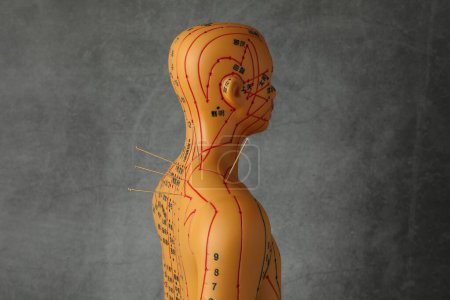 Téléchargez les photos : Acupuncture - médecine alternative. Modèle humain avec aiguilles à l'épaule sur fond gris foncé - en image libre de droit