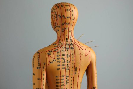 Téléchargez les photos : Acupuncture - médecine alternative. Modèle humain avec aiguilles à l'épaule sur fond gris, vue arrière - en image libre de droit