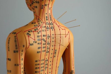 Foto de Acupuntura - medicina alternativa. Modelo humano con agujas en hombro sobre fondo gris - Imagen libre de derechos