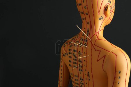 Foto de Acupuntura - medicina alternativa. Modelo humano con agujas en la espalda contra fondo negro, espacio para texto - Imagen libre de derechos