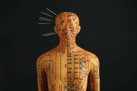 Foto de Acupuntura - medicina alternativa. Modelo humano con agujas en la cabeza sobre fondo negro - Imagen libre de derechos