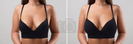Téléchargez les photos : Femme avant et après augmentation mammaire sur fond gris clair, gros plan. Collage avec photos montrant la différence entre les tailles de seins - en image libre de droit