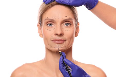 Photo for Doctor with pencil preparing patient for cosmetic surgery operation on white background, closeup - Royalty Free Image