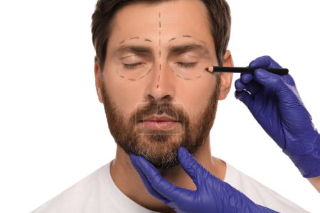 Arzt mit Bleistift bereitet Patientin auf Schönheitschirurgie auf weißem Hintergrund vor, Nahaufnahme