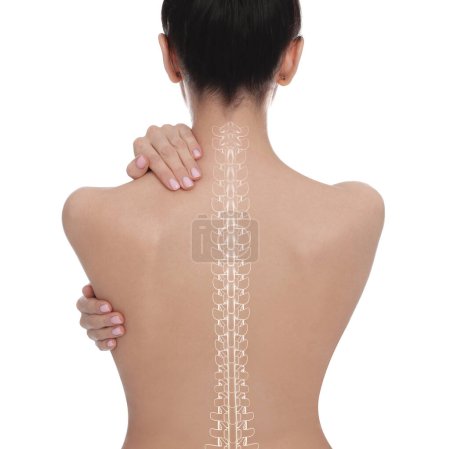 Foto de Mujer con espalda sana sobre fondo blanco. Ilustración de la columna vertebral - Imagen libre de derechos