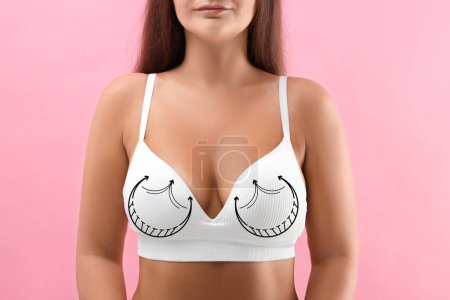 Téléchargez les photos : Chirurgie mammaire. Femme avec des marques sur le soutien-gorge sur fond rose, gros plan - en image libre de droit