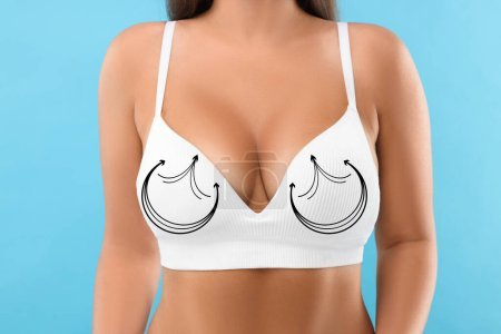 Téléchargez les photos : Chirurgie mammaire. Femme avec des marques sur le soutien-gorge sur fond bleu clair, gros plan - en image libre de droit