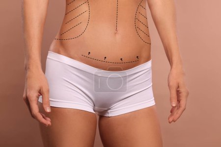 Photo for Woman with markings for cosmetic surgery on her abdomen against light brown background, closeup - Royalty Free Image