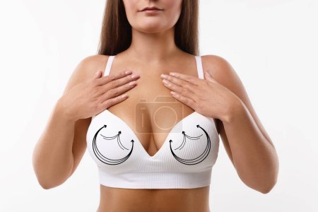 Téléchargez les photos : Chirurgie mammaire. Femme avec des marques sur le soutien-gorge sur fond blanc, gros plan - en image libre de droit