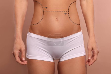 Photo for Woman with markings for cosmetic surgery on her abdomen against light brown background, closeup - Royalty Free Image