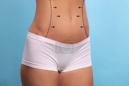 Photo for Woman with markings for cosmetic surgery on her abdomen against light blue background, closeup - Royalty Free Image