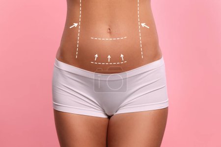 Photo for Woman with markings for cosmetic surgery on her abdomen against pink background, closeup - Royalty Free Image