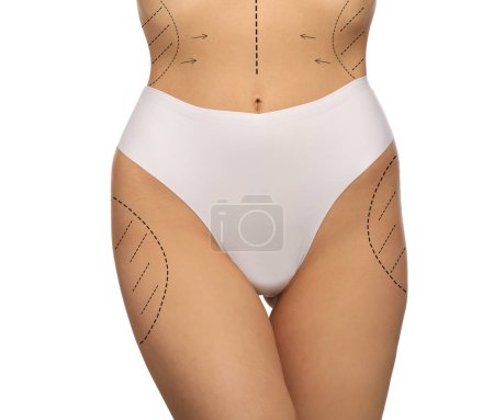 Photo for Woman with markings for cosmetic surgery on her abdomen against white background, closeup - Royalty Free Image