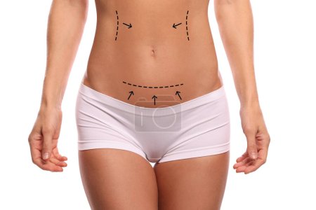 Woman with markings for cosmetic surgery on her abdomen against white background, closeup