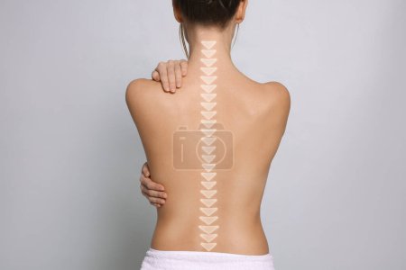 Foto de Mujer con espalda sana sobre fondo claro, primer plano. Ilustración de la columna vertebral - Imagen libre de derechos