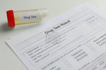 Drug test result form and container with urine sample on light table, closeup