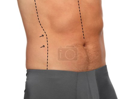 Photo for Man with markings for cosmetic surgery on his abdomen against white background, closeup - Royalty Free Image