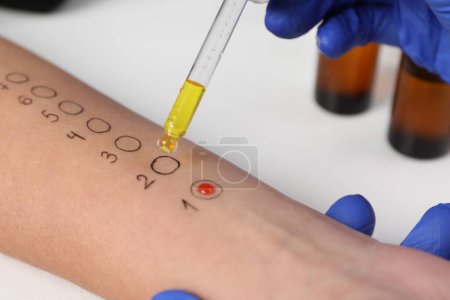 Patient undergoing skin allergy test at light table in clinic, closeup