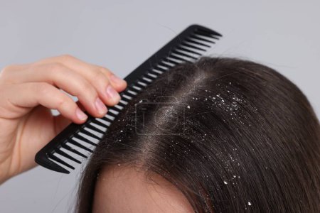 Téléchargez les photos : Femme avec peigne examinant ses cheveux et son cuir chevelu sur fond gris, gros plan. Problème de pellicules - en image libre de droit