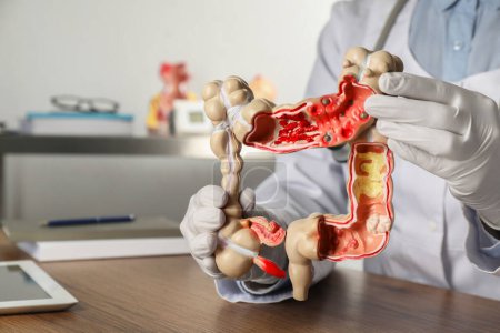 Photo for Gastroenterologist with human colon model at table in clinic, closeup - Royalty Free Image