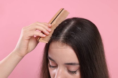 Téléchargez les photos : Femme avec peigne examinant ses cheveux et son cuir chevelu sur fond rose, gros plan. Problème de pellicules - en image libre de droit
