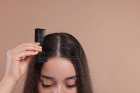 Téléchargez les photos : Femme avec peigne examinant ses cheveux et son cuir chevelu sur fond beige, gros plan avec espace pour le texte. Problème de pellicules - en image libre de droit