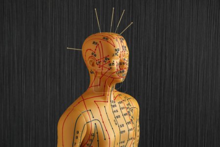 Téléchargez les photos : Acupuncture - médecine alternative. Modèle humain avec aiguilles dans la tête sur fond noir - en image libre de droit