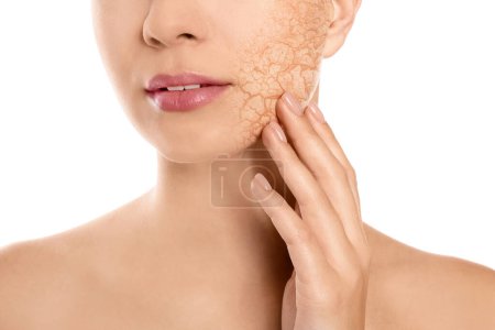 Beautiful young woman with dry skin on white background, closeup
