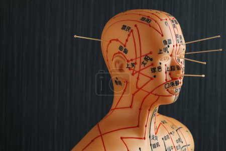 Téléchargez les photos : Acupuncture - médecine alternative. Modèle humain avec aiguilles dans la tête sur fond noir, espace pour le texte - en image libre de droit