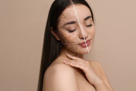 Trockene Haut. Schöne junge Frau vor und nach dem Eingriff auf beigem Hintergrund, Collage