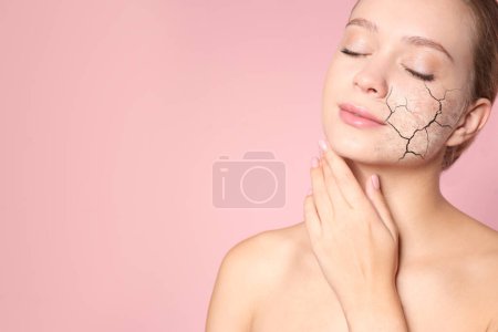 Beautiful young woman with dry skin on pink background. Space for text