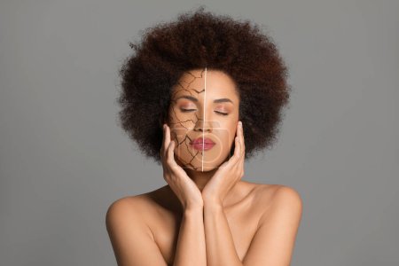 Tratamiento de la piel seca. Hermosa mujer antes y después del procedimiento sobre fondo gris, collage