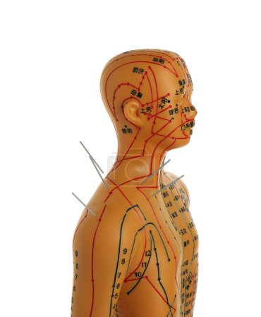 Téléchargez les photos : Acupuncture - médecine alternative. Modèle humain avec aiguilles dans l'épaule isolé sur blanc - en image libre de droit