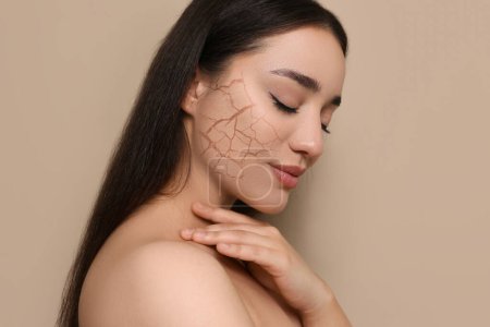 Beautiful young woman with dry skin on beige background