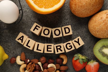 Alergia alimentaria. Diferentes productos frescos y cubos de madera sobre mesa gris, plano