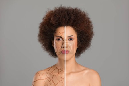 Trockene Haut. Schöne Frau vor und nach dem Eingriff auf grauem Hintergrund, Collage