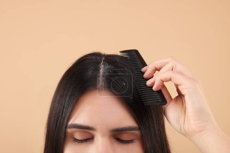 Téléchargez les photos : Femme avec peigne examinant ses cheveux et son cuir chevelu sur fond beige, gros plan. Problème de pellicules - en image libre de droit