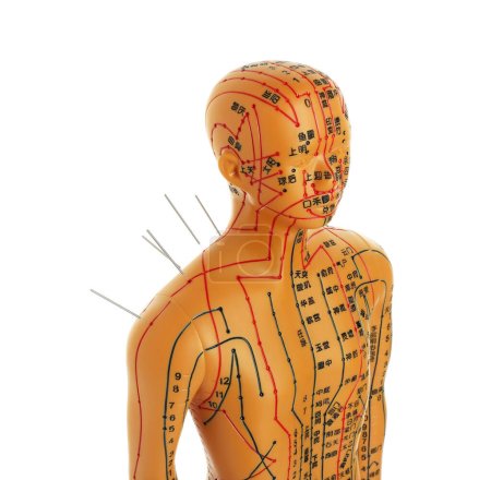 Téléchargez les photos : Acupuncture - médecine alternative. Modèle humain avec aiguilles dans l'épaule isolé sur blanc - en image libre de droit