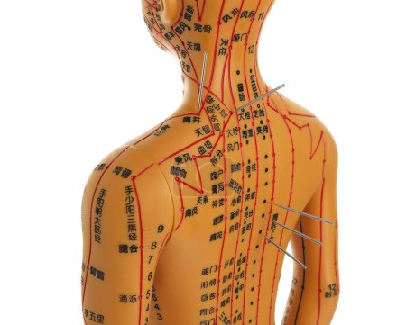 Téléchargez les photos : Acupuncture - médecine alternative. Modèle humain avec aiguilles dans le dos isolé sur blanc - en image libre de droit