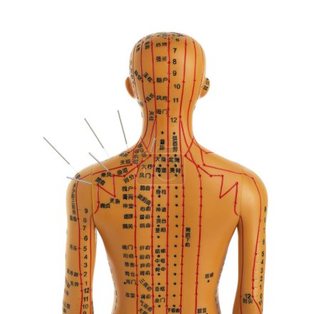 Téléchargez les photos : Acupuncture - médecine alternative. Modèle humain avec aiguilles dans l'épaule isolé sur blanc, vue de dos - en image libre de droit